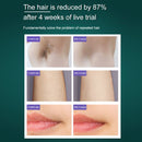 IPL Hair Removal Machine Suitable For Home Use Gentle Long Lasting Hair Removal